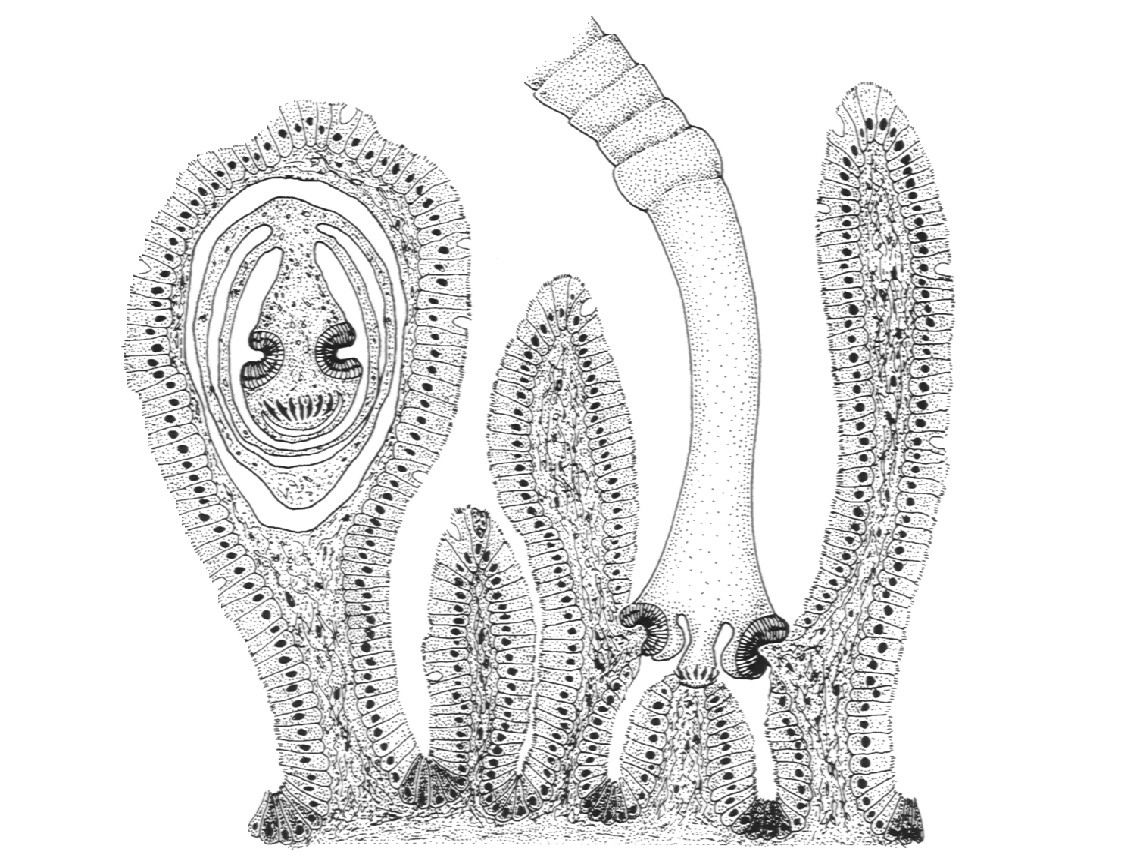Adult H. nana in small intestine