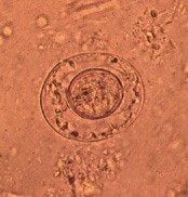 H. nana egg